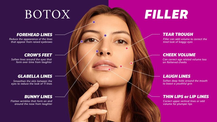 Botox vs. Fillers: Which One is Right for You?